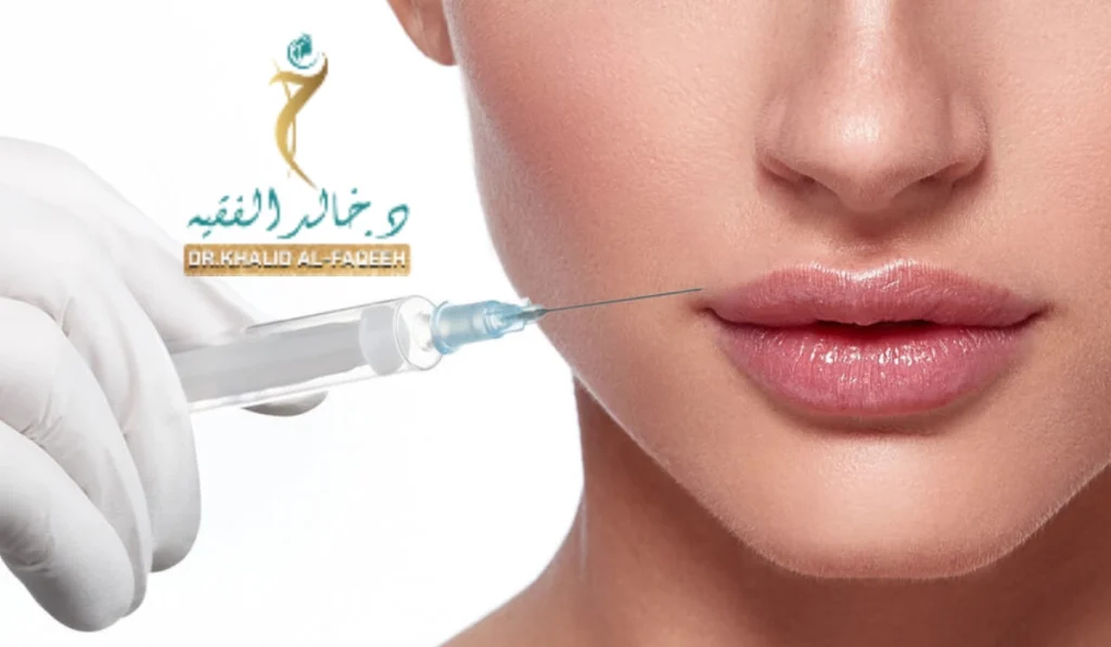 أنواع فيلر الشفايف