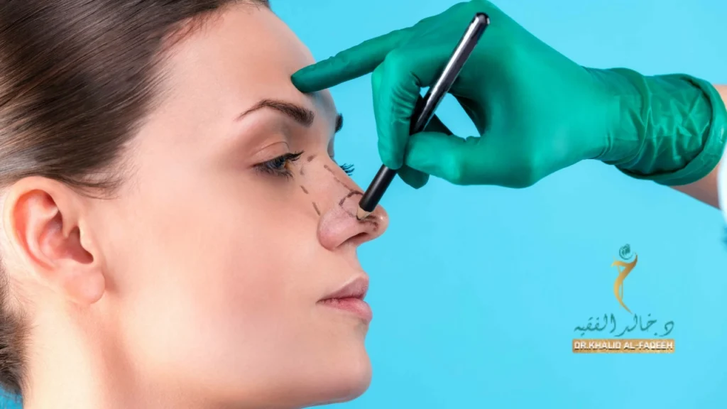 عملية تجميل الأنف اللحمي العريض