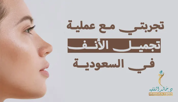 تجربتي مع عملية تجميل الأنف في السعودية