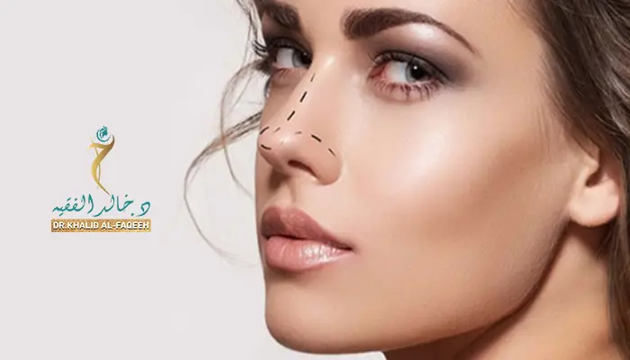 ممنوعات بعد عملية تجميل الأنف