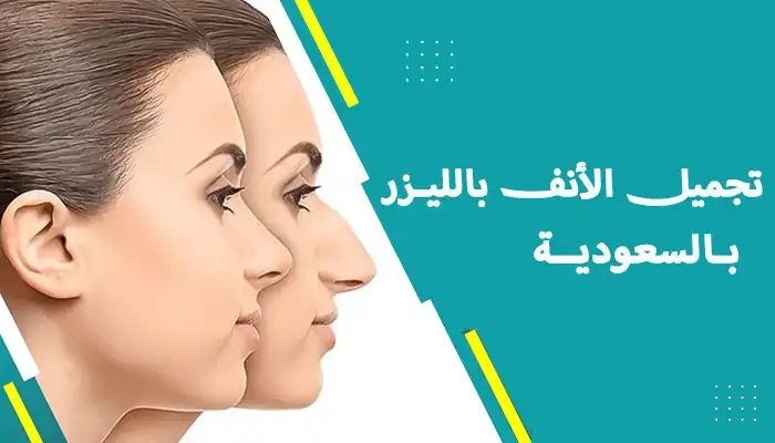 تجميل الأنف بالليزر بالسعودية