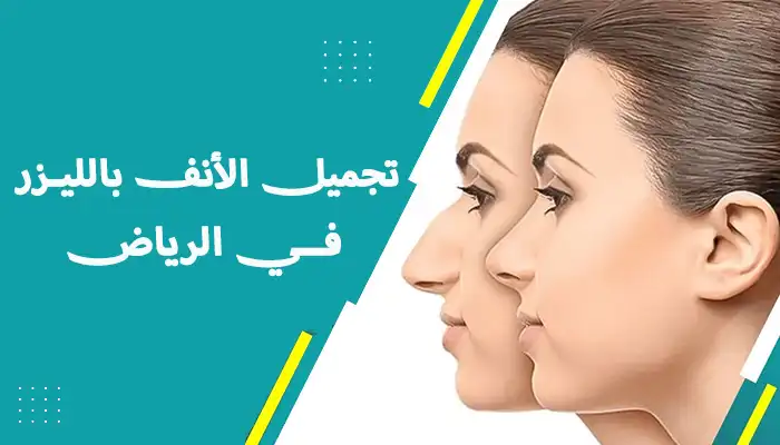 تجميل الأنف بالليزر في الرياض