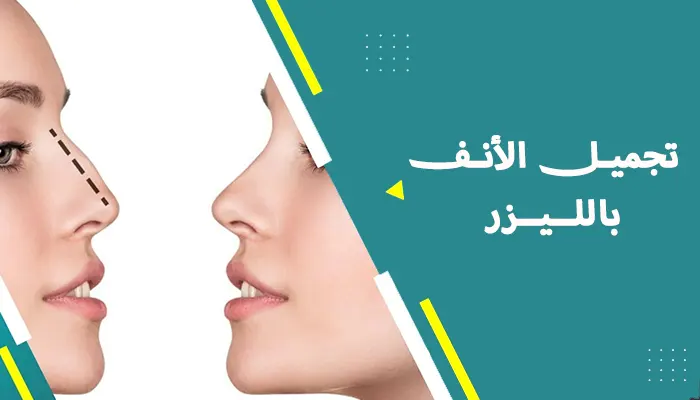 تجميل الأنف بالليزر