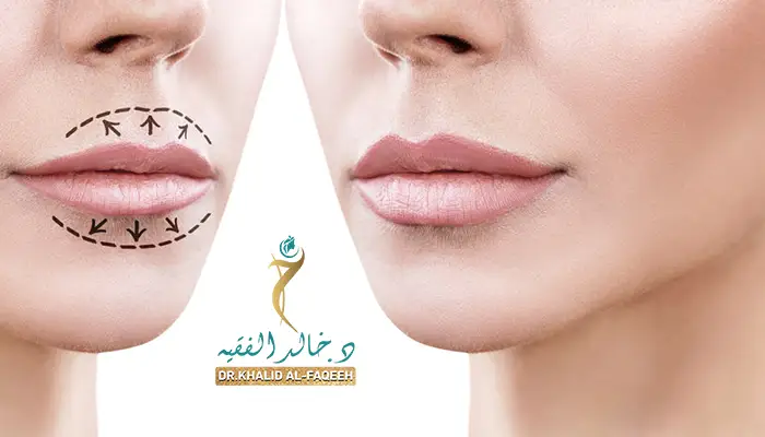 متى اعمل مساج بعد فيلر الشفايف