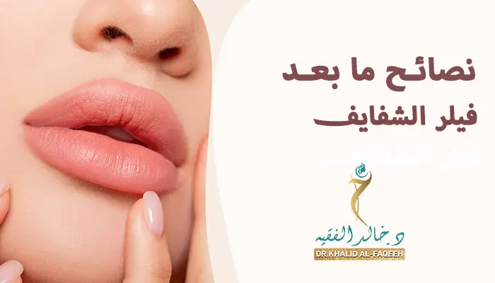 نصائح بعد فيلر الشفايف