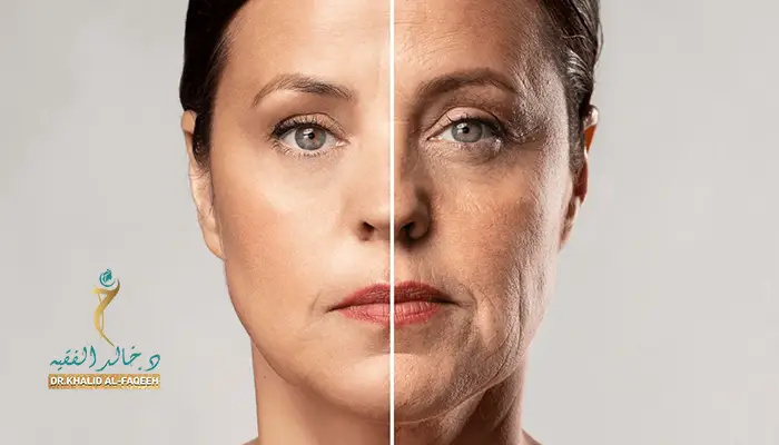 مدة التعافي بعد شد الوجه