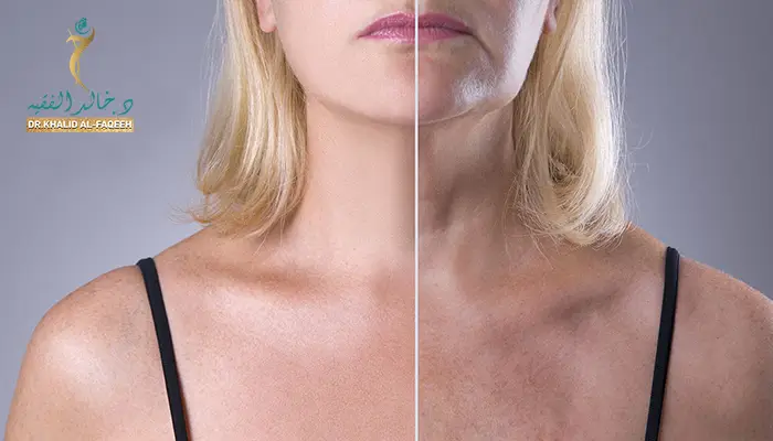 عملية شد الجلد المترهل: أحدث تقنيات تجميل الوجه والرقبة